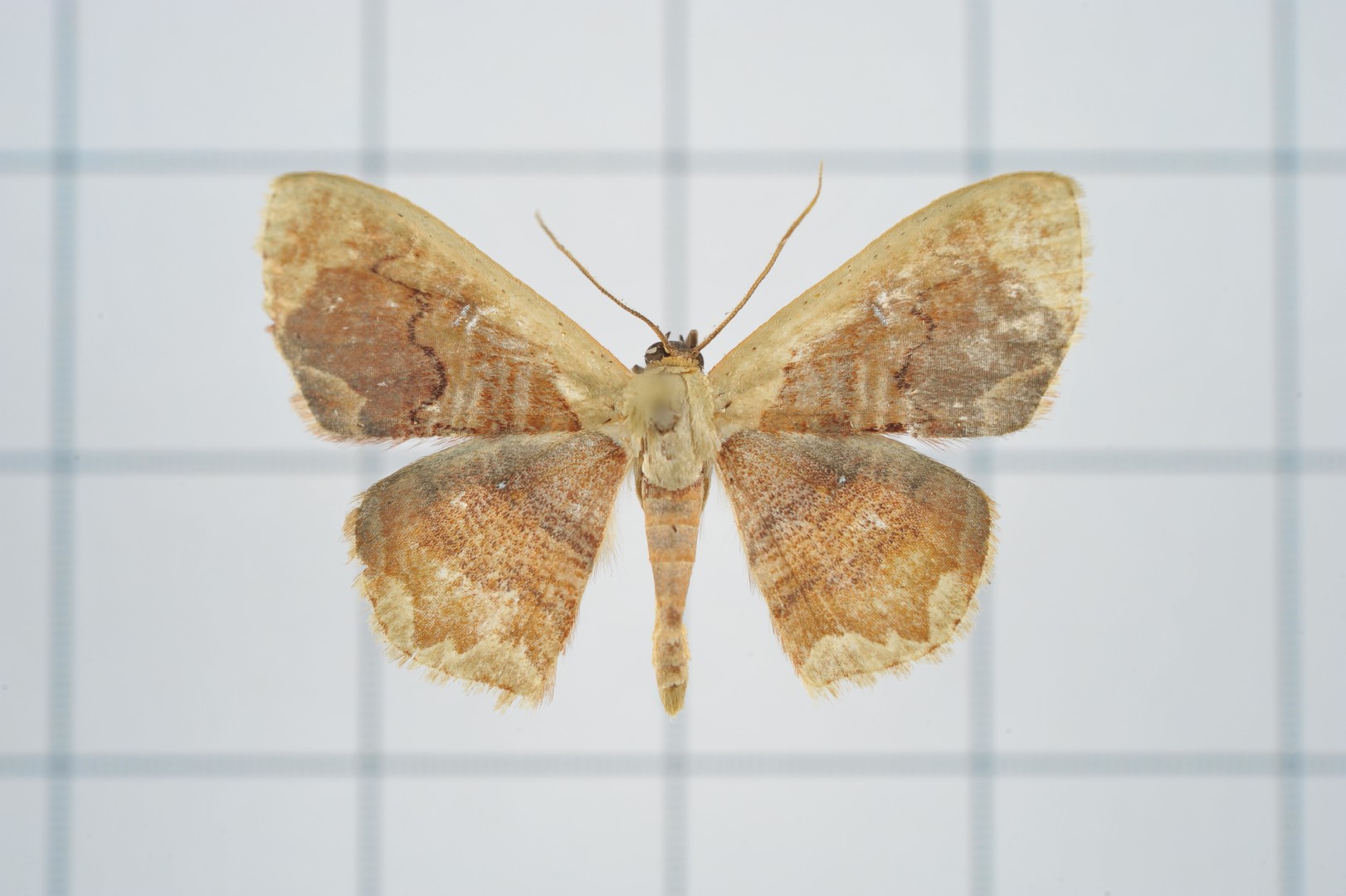 Lipomelia (Lipomelia)